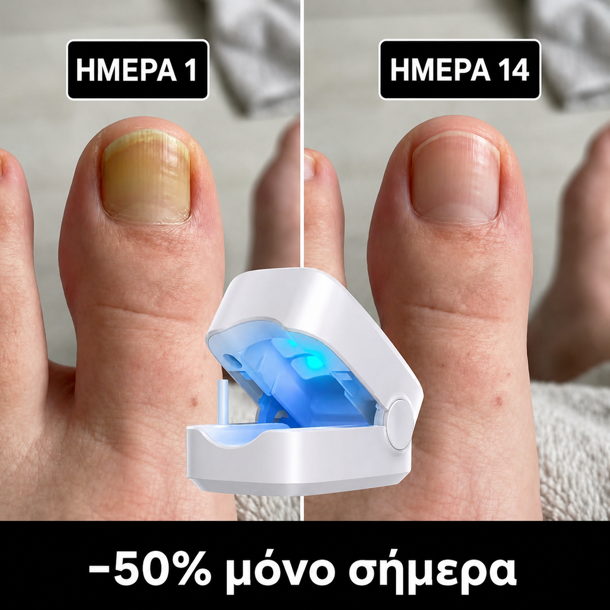 MYKONAIL