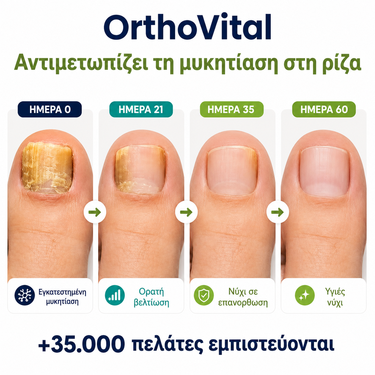 MYKONAIL