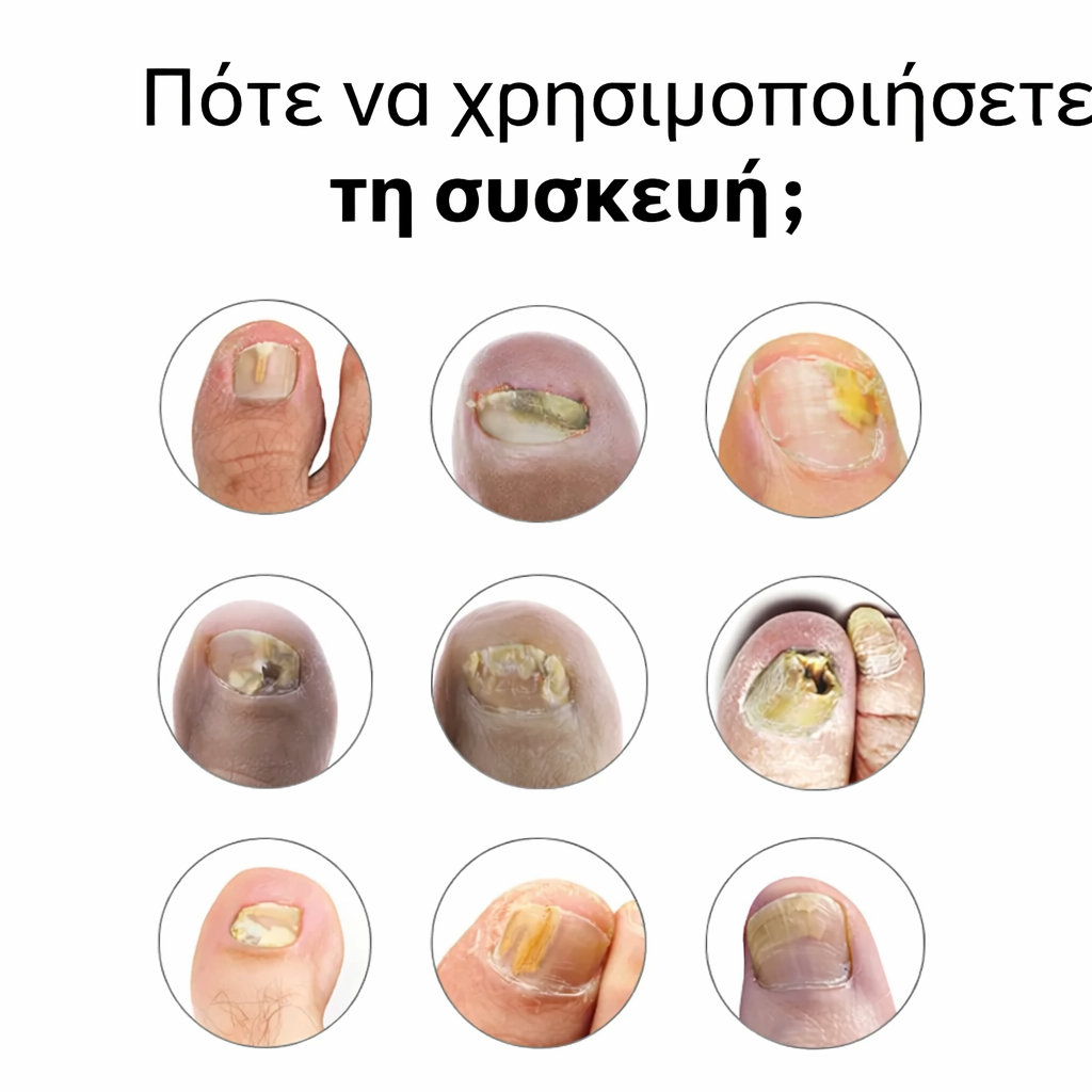 MYKONAIL